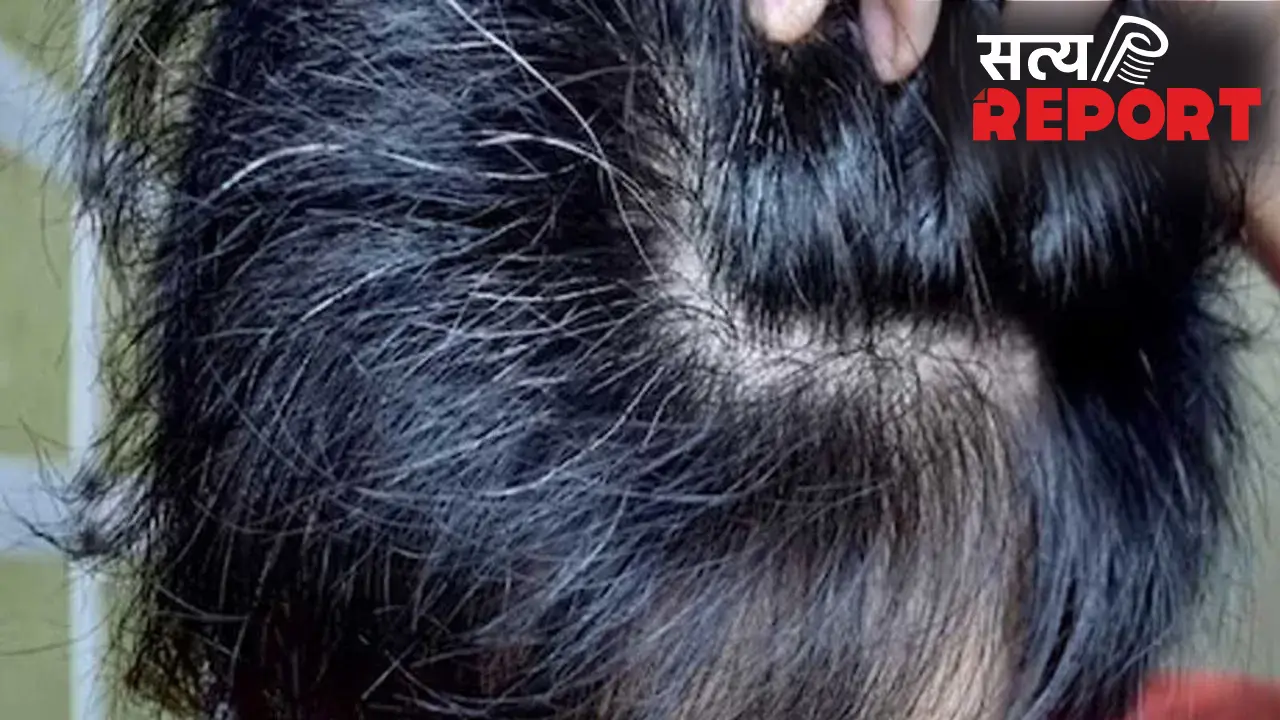 White Hair: बच्चों के बाल सफेद होने की वजह क्या है? जानिए इससे पचने के उपाय