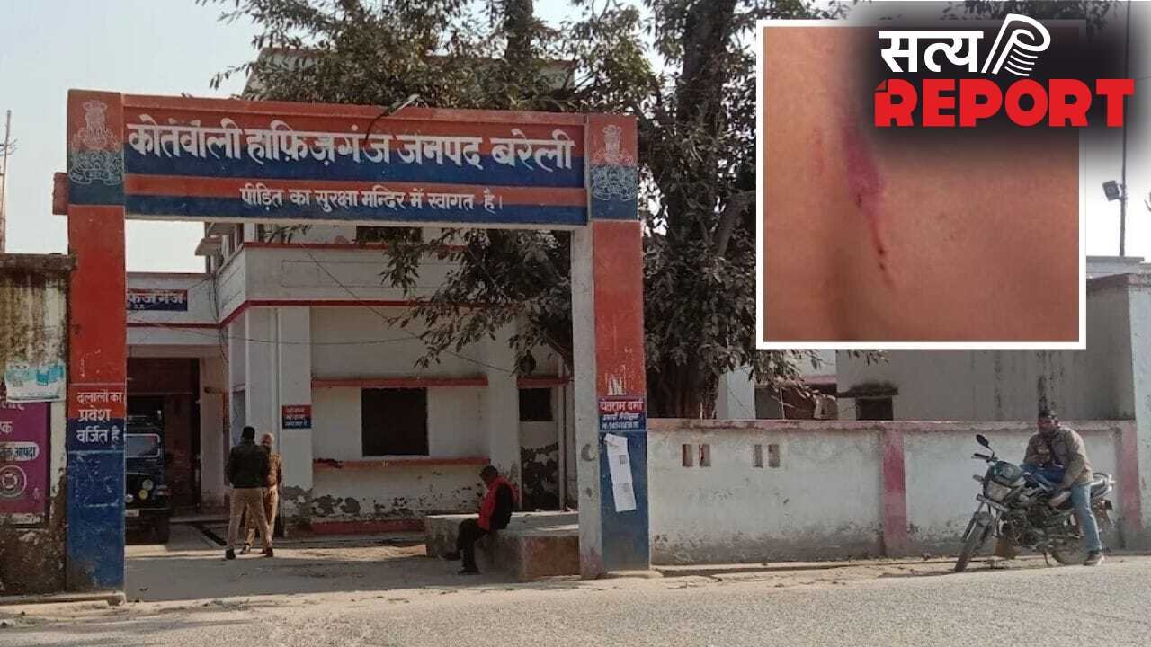 शहतूत तोड़ने की ऐसी सजा… तीन बच्चों को दी खौफनाक सजा, शख्स ने बेल्ट और केबल से पीटा