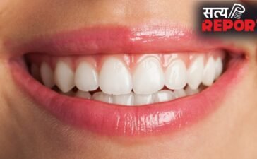 दांतों पर दिखने लगी है पीले रंग की परत, तो अपनाएं ये तरीका, चमक जाएंगे आपके दांत