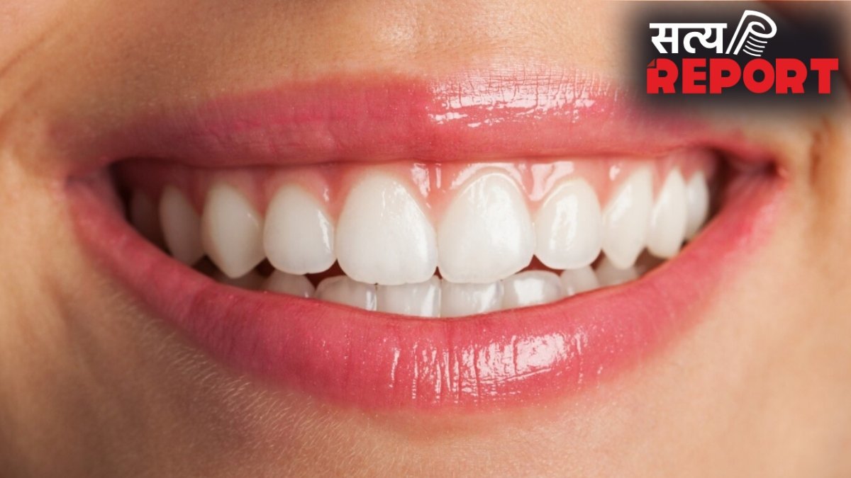 दांतों पर दिखने लगी है पीले रंग की परत, तो अपनाएं ये तरीका, चमक जाएंगे आपके दांत