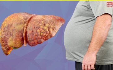 ग्लोबल लेवल पर तेजी से बढ़ रही लीवर की समस्या, लैंसेट रिपोर्ट का दावा- 2050 में हो जाएंगे 2 अरब लोग पीड़ित