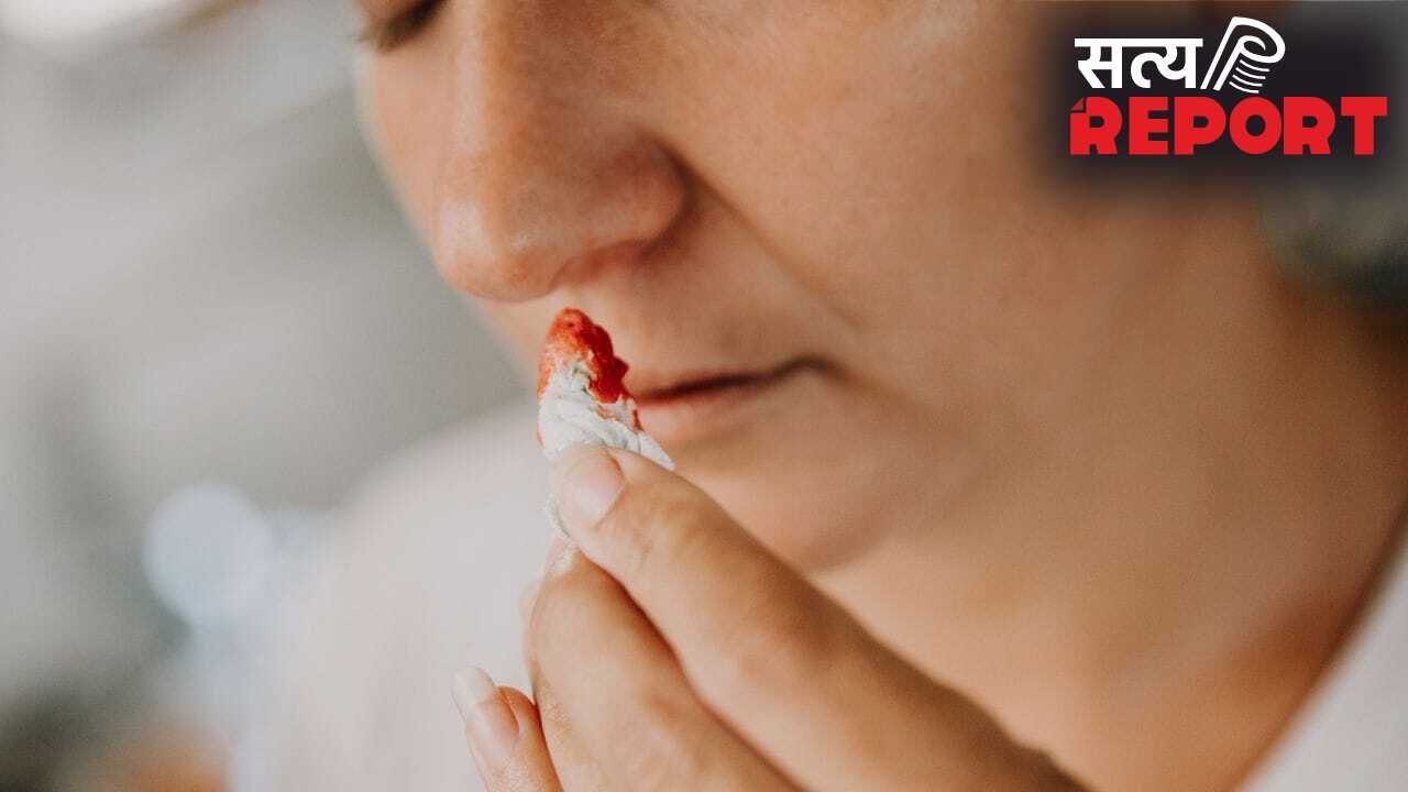 गर्मियों में नाक से खून आ गया है तो तुरंत क्या करें, ये क्यों होता है