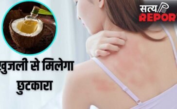 Summer Skin Care Remedy: गर्मी से हो रही खुजली-महीन दानों का होगा सफाया, नारियल तेल में मिलाकर लगा लें ये 1 चीज