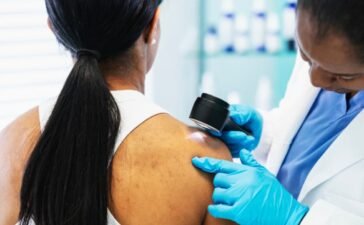 क्या गर्मियों में बढ़ जाता है स्किन कैंसर का खतरा? एक्सपर्ट से जानें