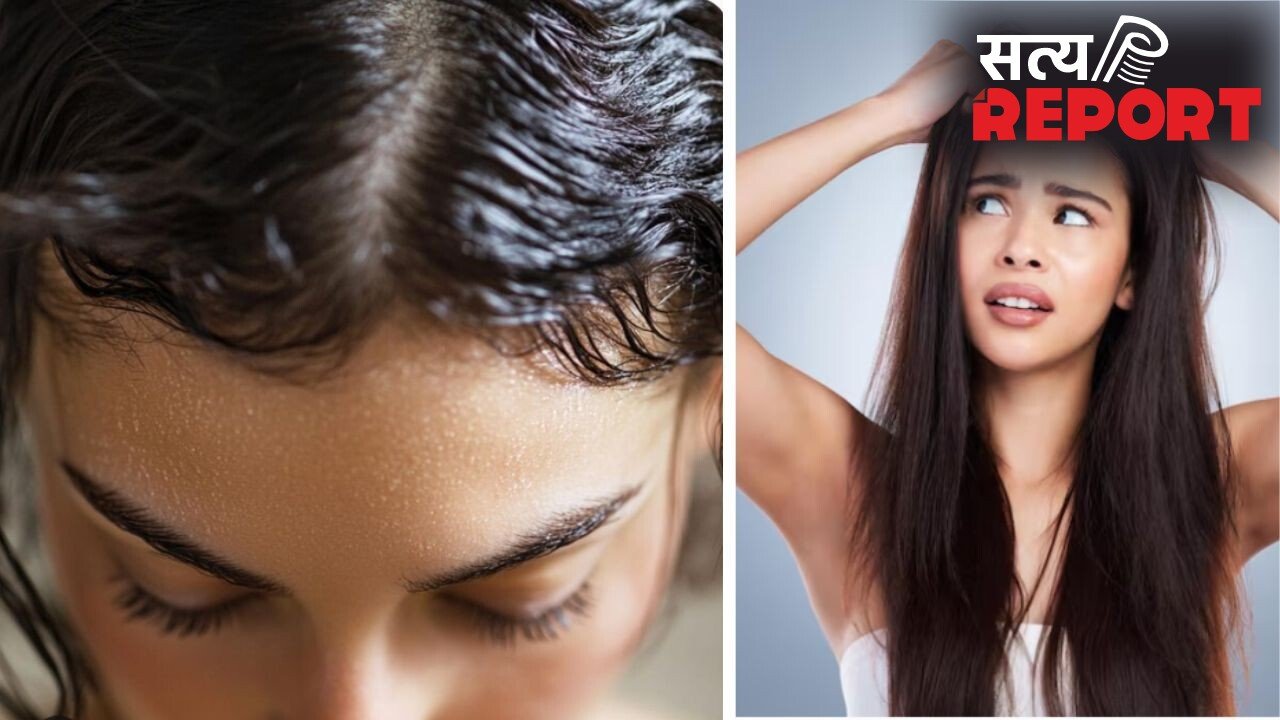 बालों को चिपचिपा होने से बचाने के लिए अपनाएं ये 3 नुस्खे, ऑयली स्कैल्प से मिल सकती है राहत