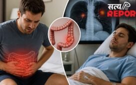 Health Alert: क्या मामूली कब्ज हो सकता है कोलन कैंसर का संकेत? 29 साल के युवक के केस से समझें सारी कहानी