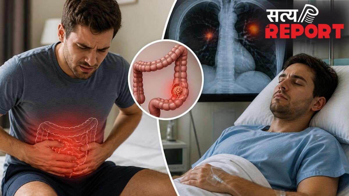 Health Alert: क्या मामूली कब्ज हो सकता है कोलन कैंसर का संकेत? 29 साल के युवक के केस से समझें सारी कहानी