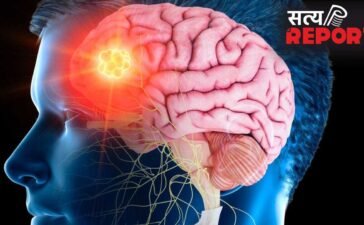 Brain stroke recovery : ब्रेन स्ट्रोक के बाद रिकवरी भी है जरूरी, डॉक्टर से जानें टिप्स