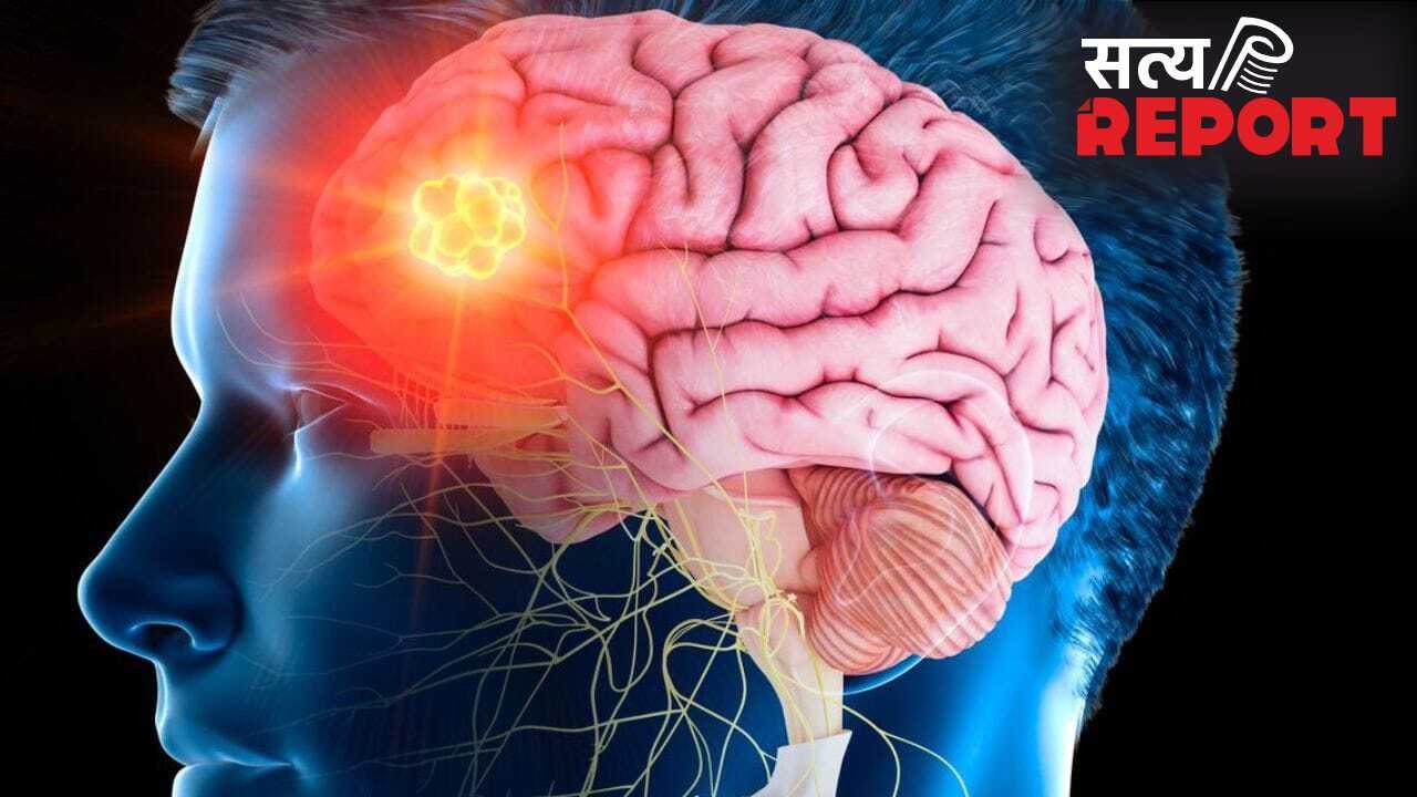 Brain stroke recovery : ब्रेन स्ट्रोक के बाद रिकवरी भी है जरूरी, डॉक्टर से जानें टिप्स