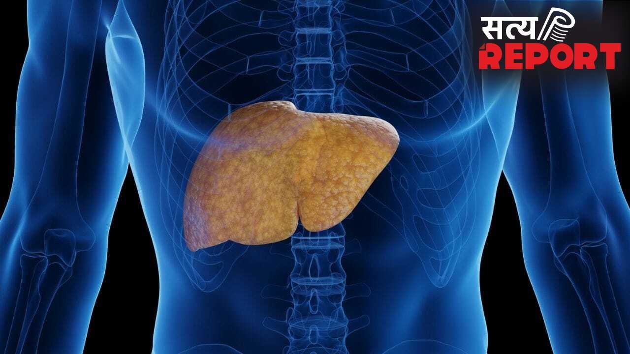 फैटी लिवर का असर शरीर के किन अंगों पर पड़ सकता है? एक्सपर्ट से जानें