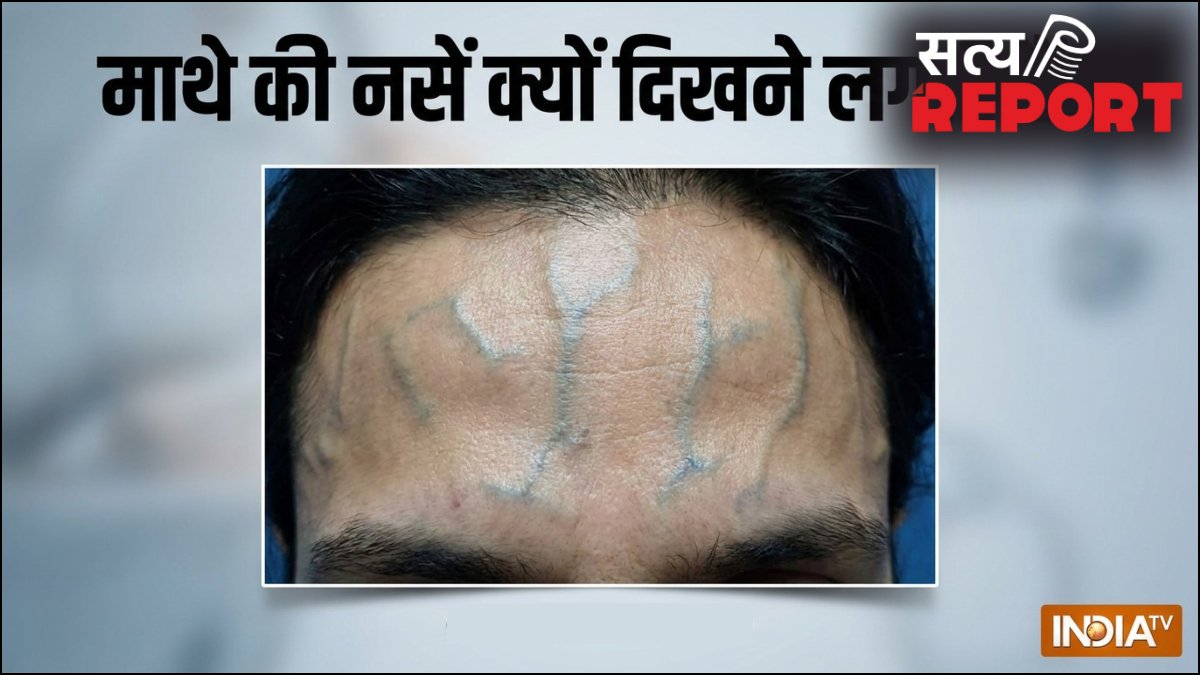 माथे की नसें क्यों दिखने लगती हैं, नस फड़कने पर क्या करें, जानिए इसके कारण और ठीक करने के उपाय