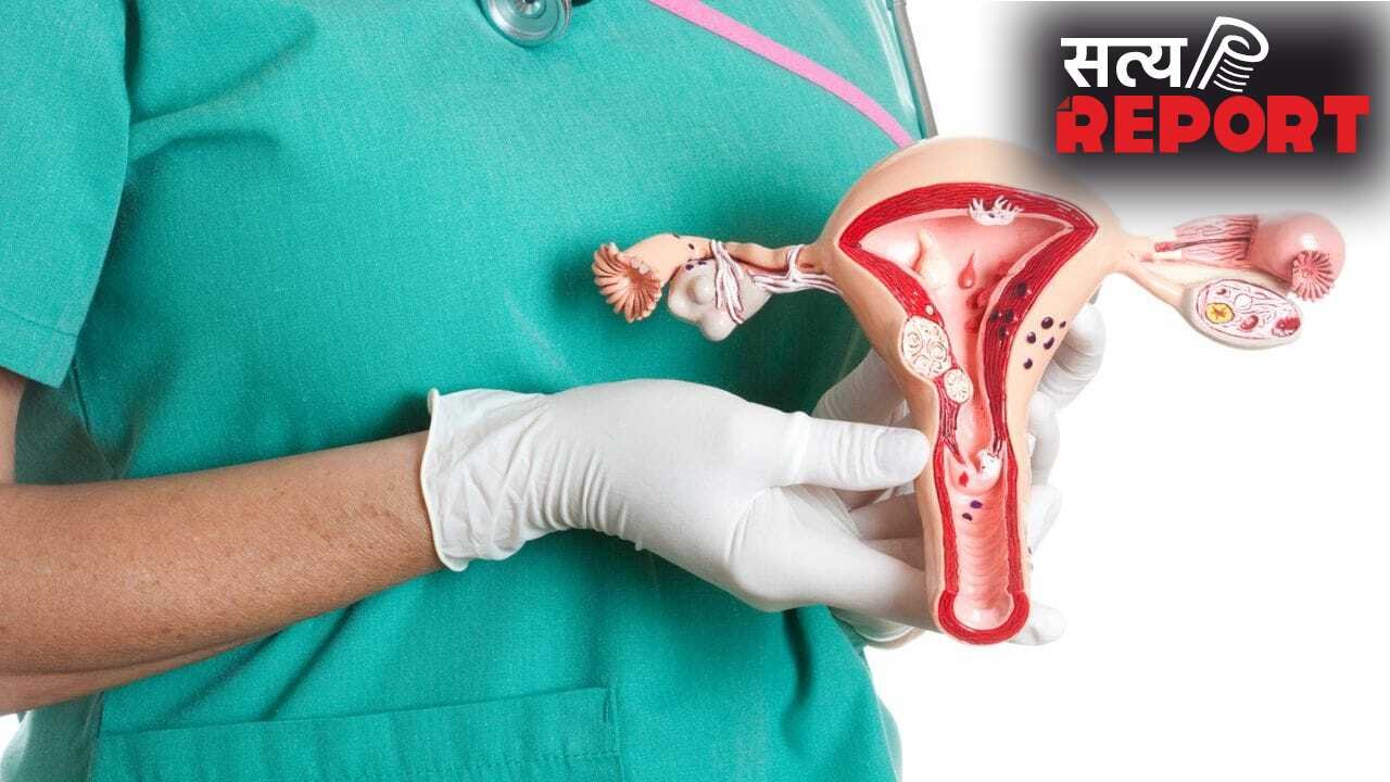 महिलाओं में कितने सेंटीमीटर की ओवरी सिस्ट बिना सर्जरी के ठीक हो सकती है? एक्सपर्ट से जानें