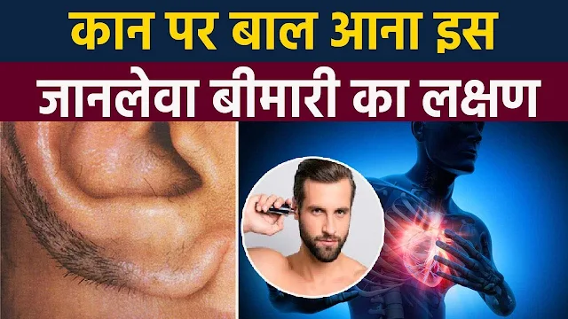 कान पर बाल दिखें तो हो जाएँ सावधान, इस जानलेवा बीमारी का है लक्षण…
