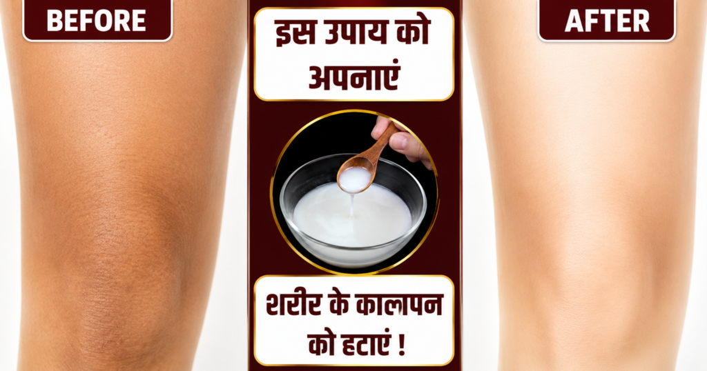 इन घरेलु नुस्खों को अपनाकर शरीर के काले अंगों को इस तरह से करें साफ …