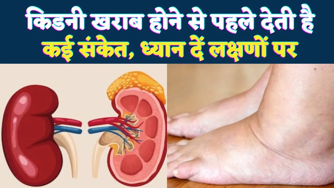 पैरों की सूजन और सांस फूलना किडनी फेलियर का संकेत ! जानें शुरुआती लक्षण और बचाव..