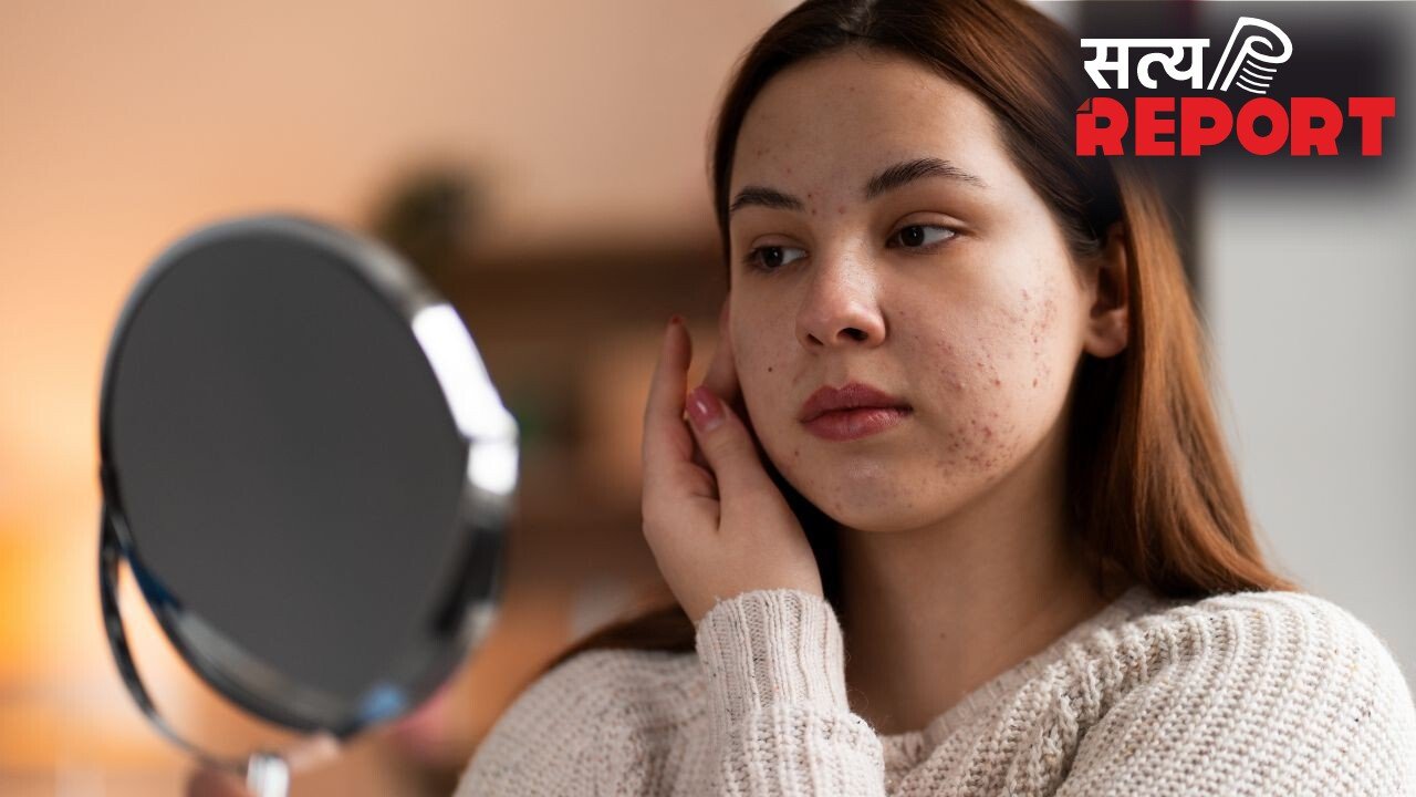 चेहरे के काले धब्बों को नजरअंदाज न करें, पिग्मेंटेशन के हो सकते हैं संकेत