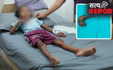 गोरखपुर में 7 साल की बच्ची के पेट से निकला बालों का गुच्छा, डॉक्टर भी रह गए हैरान; बाल खाने की आदत थी गोरखपुर में 7 साल की बच्ची के पेट से निकला बालों का गुच्छा, डॉक्टर भी रह गए हैरान; बाल खाने की आदत थी